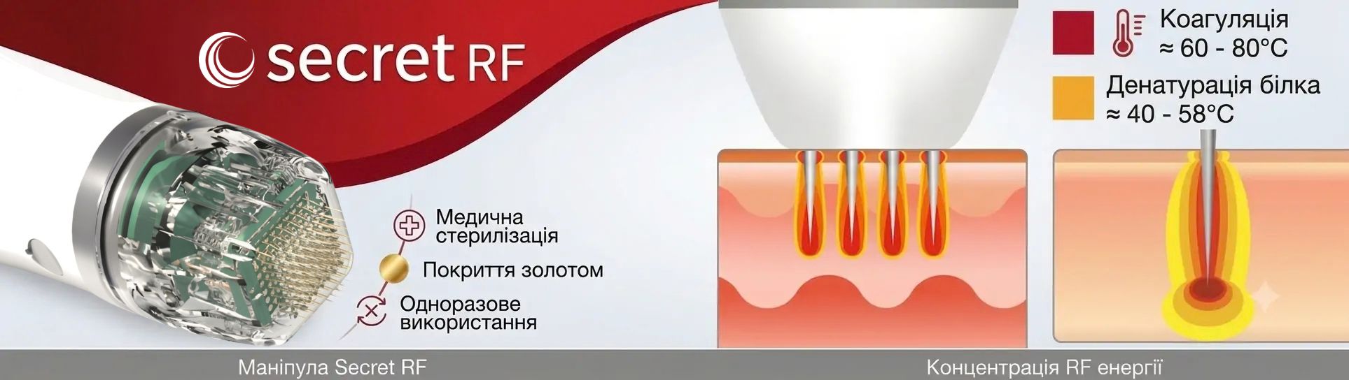 Classys Secret RF: Апарат фракційного RF-ліфтингу ➔ купити в Україні | Alfaspa зображення 18