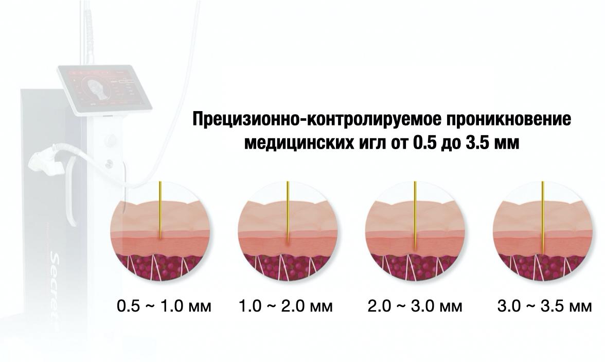 Classys Secret RF: Аппарат фракционного RF-лифтинга ➔ купить в Украине | Alfaspa изображение 14