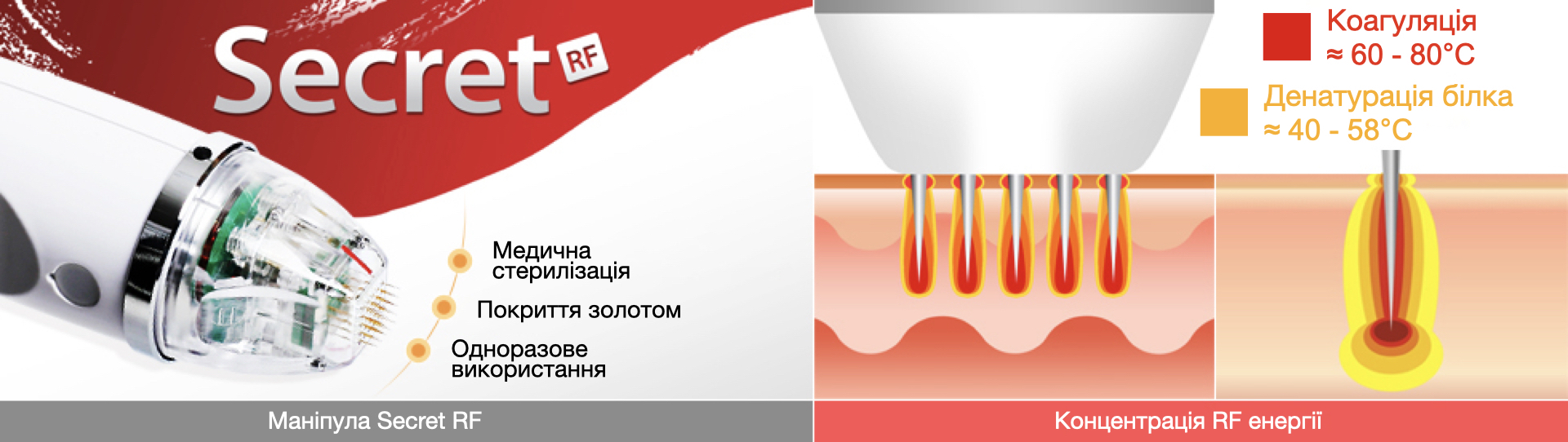 Classys Secret RF: Апарат фракційного RF-ліфтингу ➔ купити в Україні | Alfaspa зображення 18