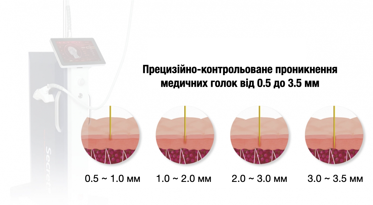 Classys Secret RF: Апарат фракційного RF-ліфтингу ➔ купити в Україні | Alfaspa зображення 14