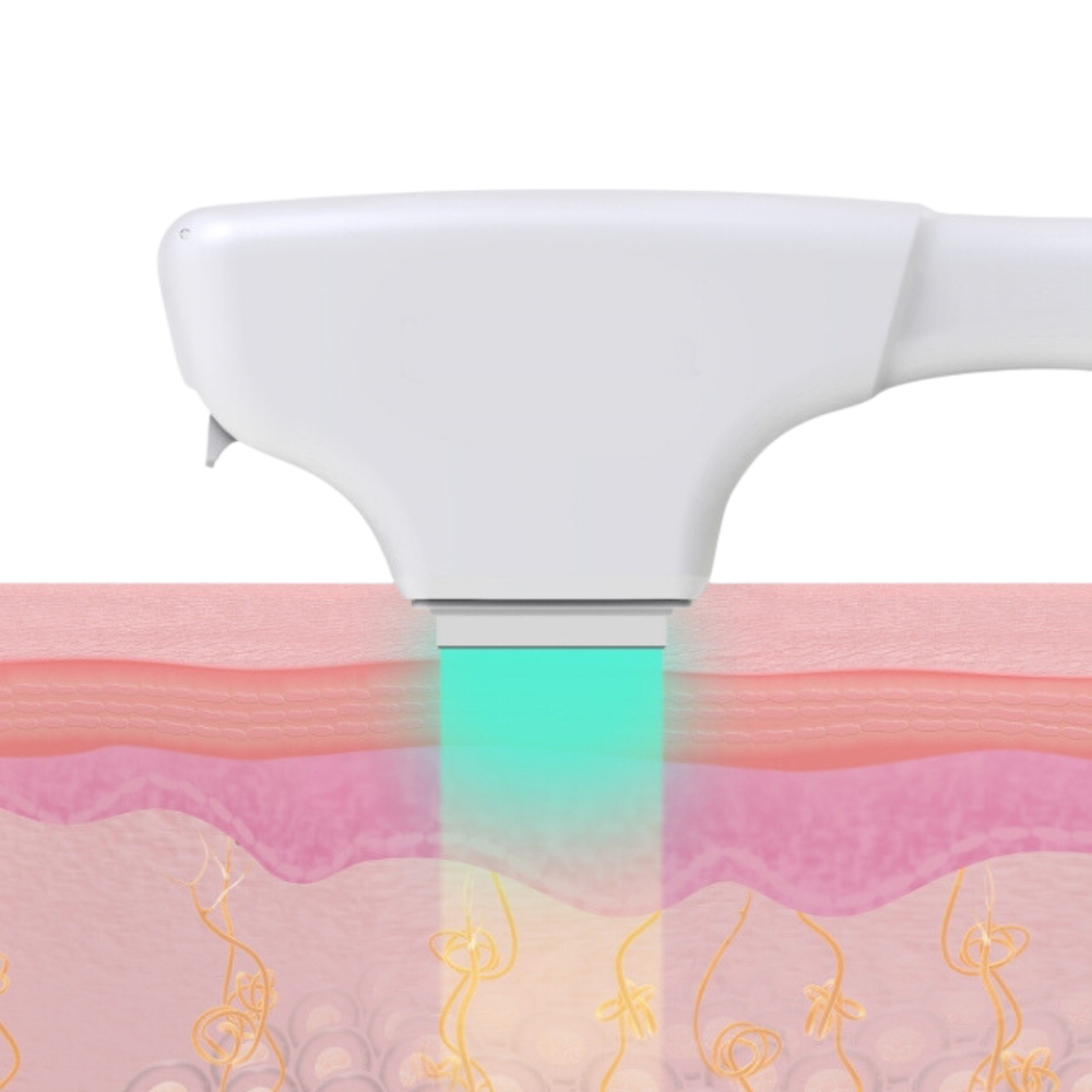 Classys ilooda SUPER VELOCE 4800: Апарат для фотоомолодження ➔ купити в Україні | Alfaspa зображення 14