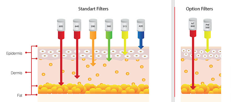 Classys ilooda SUPER VELOCE 4800: Апарат для фотоомолодження ➔ купити в Україні | Alfaspa зображення 15